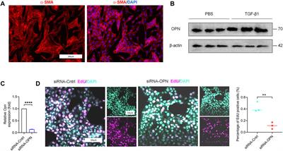 Effective delivery of osteopontin small interference RNA using exosomes suppresses liver fibrosis via TGF-β1 signaling